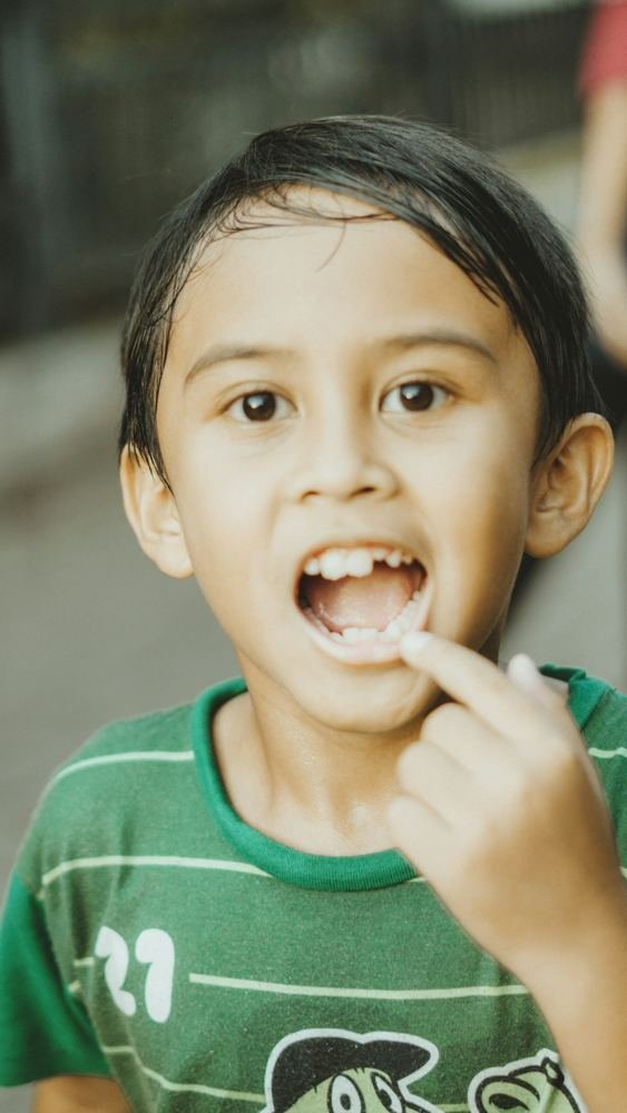 Tooth Coloured Fillings Kids Dombivli
